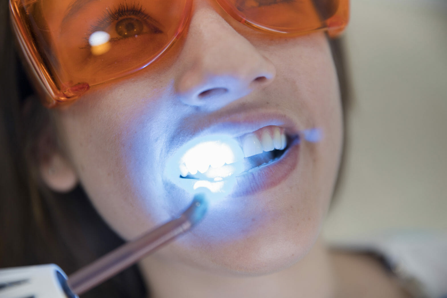 Dental Laser Treatment