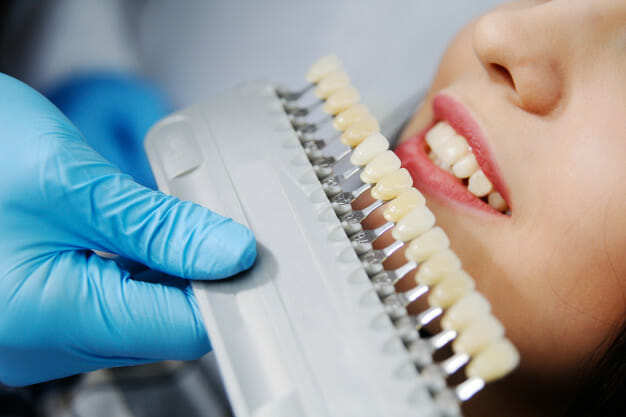 Tooth Whitening with Dental Veneers