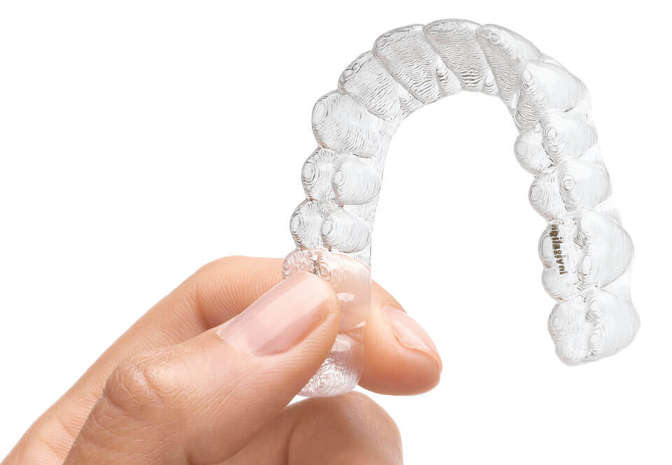 invisalign