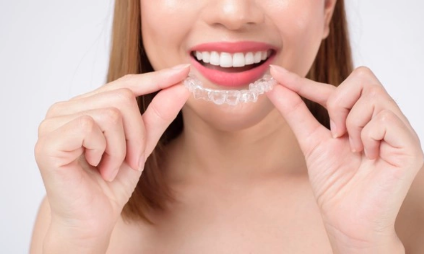 5 Tips To Maintain Your Invisalign Aligners