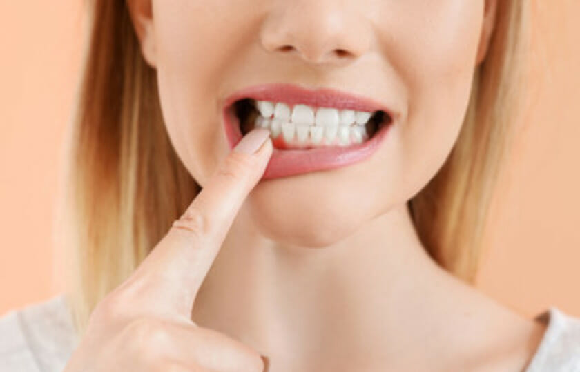 periodontal treatment in Dallas